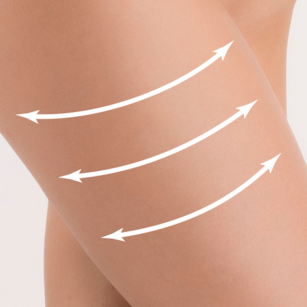 Strong Lipo & Stretch Marks Body Cream